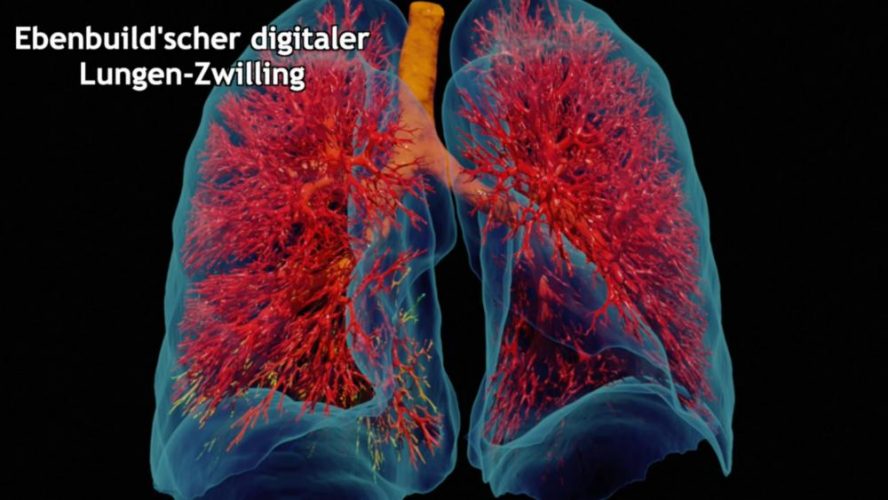 Kei W. Müller (Ebenbuild) über ihren digitalen Lungen-Zwilling und die Unterstützung seitens Intel